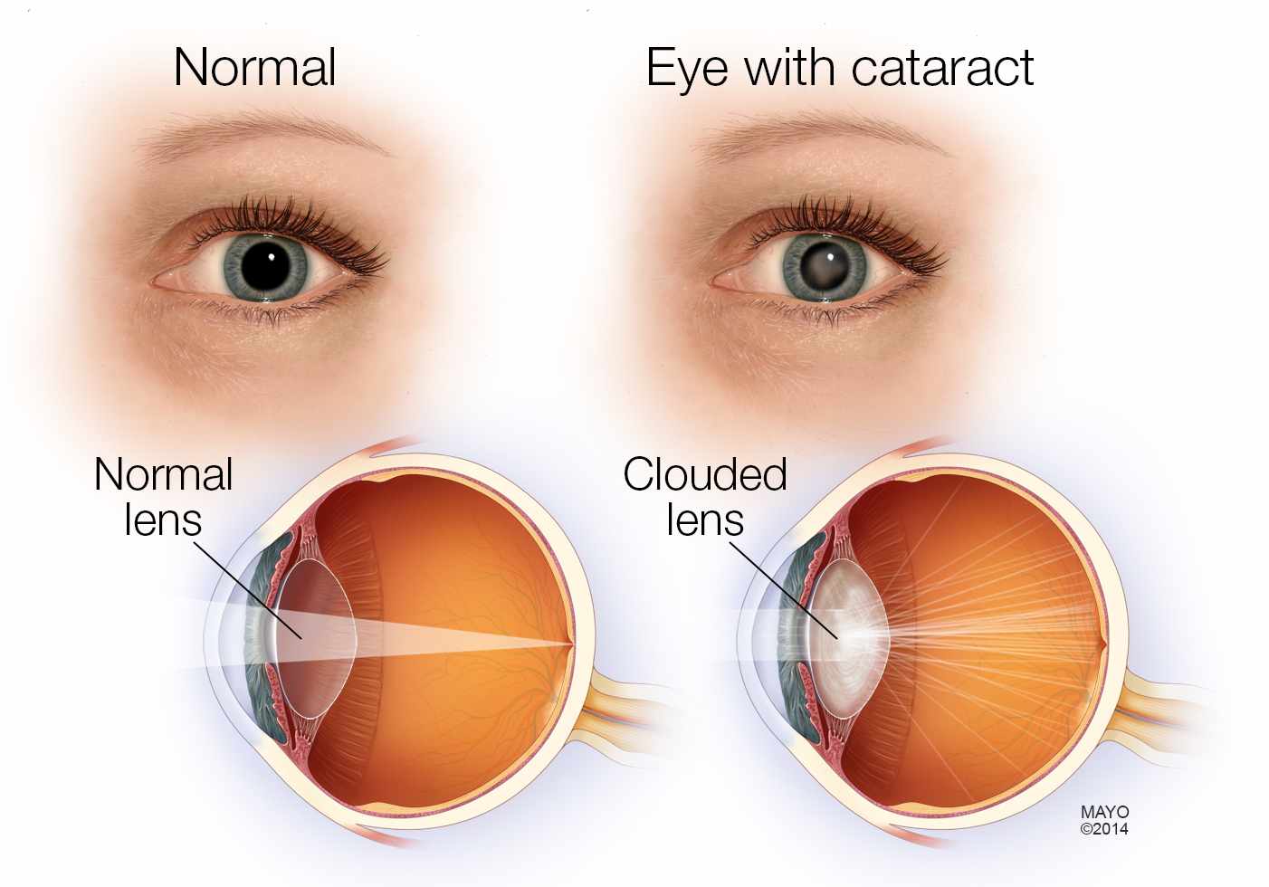 Cataract Jaya Eye Care Centre Is An NABH Accredited Eye Care Hospital